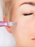 Microneedling | Microagujas ⭐️