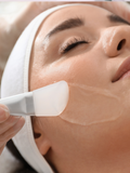 Renewal Peel | Exfoliación con Ácidos ⭐️