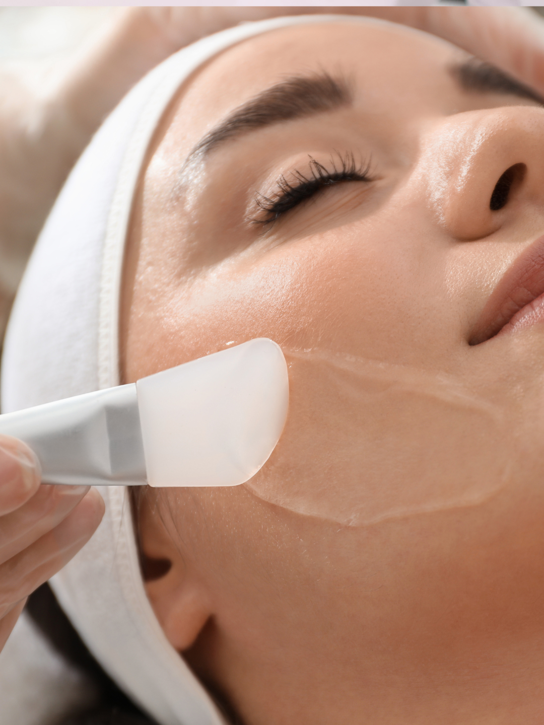 Renewal Peel | Exfoliación con Ácidos ⭐️